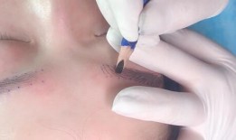 爆料桂哥抽脂视频教程全集,轻松掌握塑形技巧